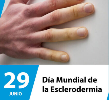 📒29 de junio | Día Mundial de la Esclerodermia imagen-78