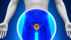 Baja la mortalidad por cáncer de próstata en Argentina gracias a la detección temprana Baja la mortalidad por cáncer de próstata en Argentina gracias a la detección temprana imagen-2