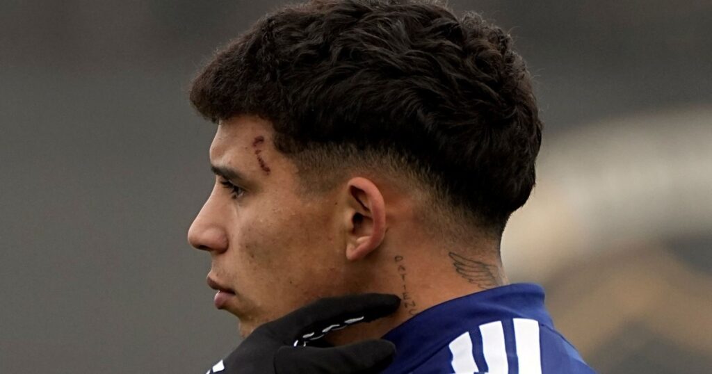 Terrible: así le quedó la cara a Leo Flores tras el patadón en el amistoso de Boca con Paranaense Terrible: así le quedó la cara a Leo Flores tras el patadón en el amistoso de Boca con Paranaense imagen-40