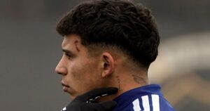 Terrible: así le quedó la cara a Leo Flores tras el patadón en el amistoso de Boca con Paranaense imagen-1