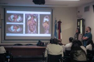 Un año de estudios y múltiples biopsias: el Hospital Madariaga confirmó un cáncer de pulmón en un caso excepcional imagen-1