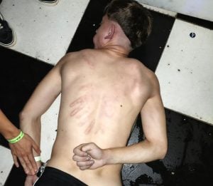 Denuncian que un joven fue golpeado por personal de seguridad en un boliche de Posadas: “Hoy mi hijo puede contar la historia” imagen-7