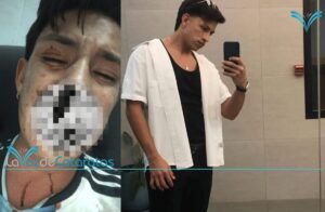 Denunció que su hermano fue atacado por cuatro personas a la salida de un boliche imagen-75