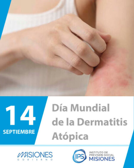 🩷 14 de septiembre | Día Mundial de la Dermatitis Atópica imagen-85