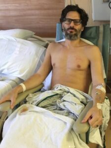 Joe Manganiello mostró las impactantes secuelas de la extraña enfermedad que padece: “No puedo creer que esté vivo” Joe Manganiello mostró las impactantes secuelas de la extraña enfermedad que padece: “No puedo creer que esté vivo” imagen-1