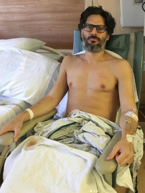 Joe Manganiello mostró las impactantes secuelas de la extraña enfermedad que padece: “No puedo creer que esté vivo” Joe Manganiello mostró las impactantes secuelas de la extraña enfermedad que padece: “No puedo creer que esté vivo” imagen-105