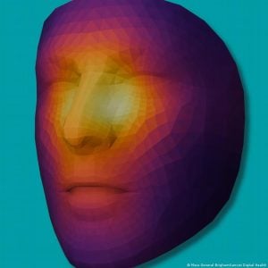Desarrollaron una inteligencia artificial que predice la supervivencia al cáncer a partir de una foto del rostro imagen-7